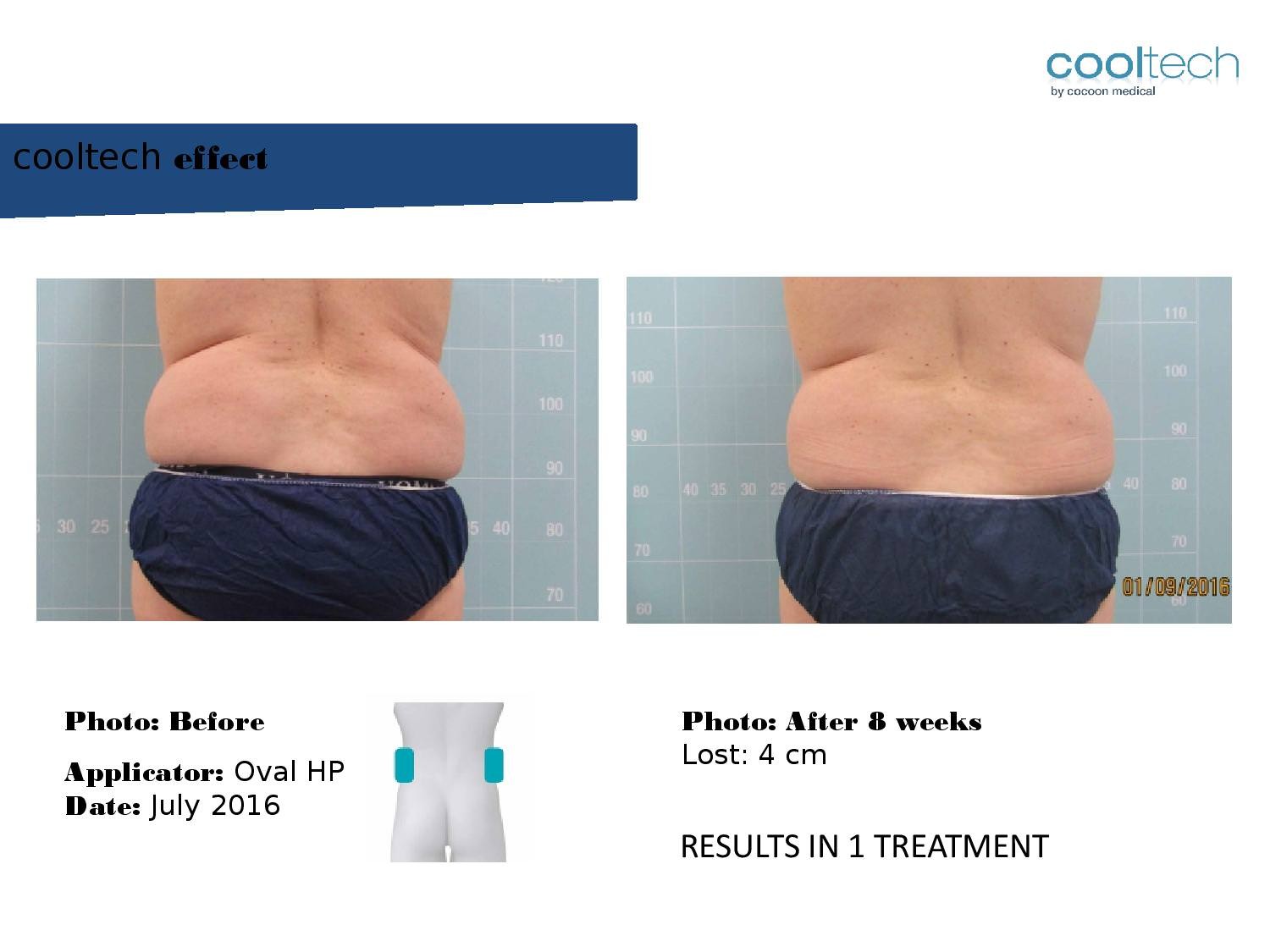 Presentation Cooltech ENG Wigmore Days Novaaaa1-page-002